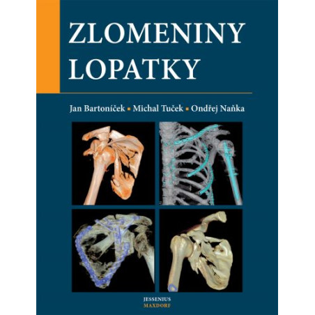 Zlomeniny lopatky