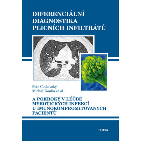 Diferenciální diagnostika plicních infiltrátů
