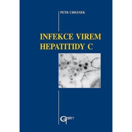 Infekce virem hepatitidy C