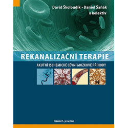 Rekanalizační terapie - Akutní ischemické cévní mozkové příhody