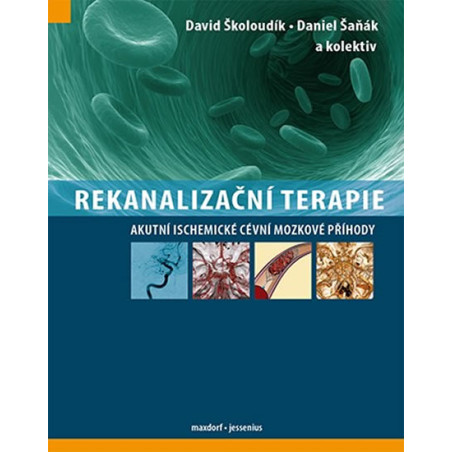Rekanalizační terapie - Akutní ischemické cévní mozkové příhody